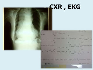 CXR , EKG
 