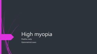 High myopia
Madiha nazly
Optometrist/coavs
 