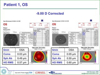Patient 1, OS

                   -9.00 D Corrected




6mm       OSA               6mm         OSA
Coma     0.03 µm            Coma       0.05 µm
Sph Ab   0.49 µm            Sph Ab     0.55 µm
HO RMS   0.57 µm            HO RMS     0.60 µm


                                                        ©DZ Reinstein 2009
                                                 dzr@londonvisionclinic.com
 