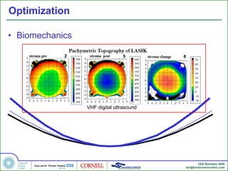 Optimization

• Biomechanics




                 VHF digital ultrasound




                                                 ©DZ Reinstein 2009
                                          dzr@londonvisionclinic.com
 