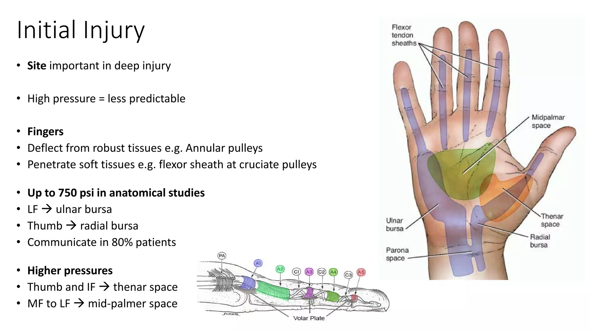 High pressure injection injuries Dr Sean Nicklin | PDF