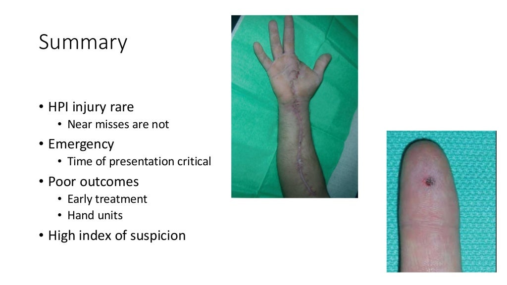 High pressure injection injuries Dr Sean Nicklin