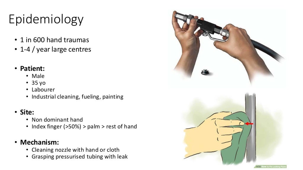 High pressure injection injuries Dr Sean Nicklin