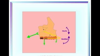 HIGH PULL HEADGEAR.pptx