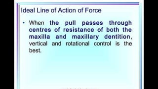 HIGH PULL HEADGEAR.pptx