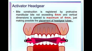 HIGH PULL HEADGEAR.pptx