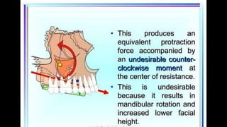 HIGH PULL HEADGEAR.pptx
