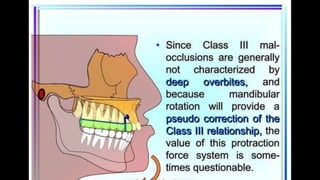 HIGH PULL HEADGEAR.pptx