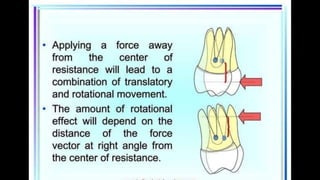 HIGH PULL HEADGEAR.pptx