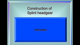 HIGH PULL HEADGEAR.pptx