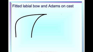 HIGH PULL HEADGEAR.pptx