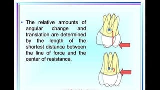 HIGH PULL HEADGEAR.pptx