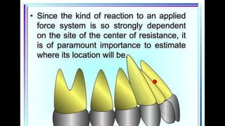 HIGH PULL HEADGEAR.pptx