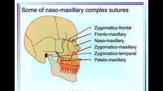 HIGH PULL HEADGEAR.pptx