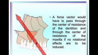 HIGH PULL HEADGEAR.pptx