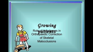 HIGH PULL HEADGEAR.pptx