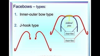 HIGH PULL HEADGEAR.pptx