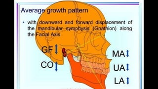 HIGH PULL HEADGEAR.pptx