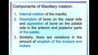 HIGH PULL HEADGEAR.pptx