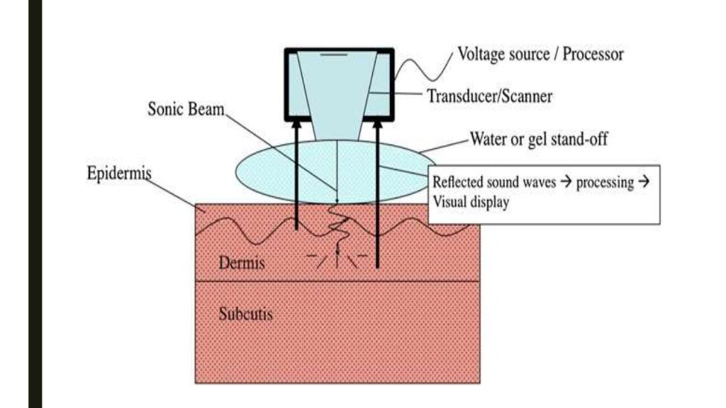 High resolution ultrasound in dermatology