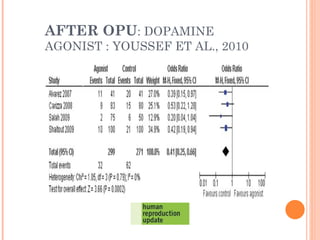 AFTER OPU : DOPAMINE AGONIST : YOUSSEF ET AL., 2010  