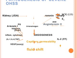 PATHOGENESIS OF SEVERE OHSS Kidney (JGA)   rorenin  Ovary                   ace  PG   Angiotensin II   A-tensin I  A-tensinogen  histamin   (liver) inflam. cytokines   ANGIOGENESIS   (IL-1,IL-6,TNF)  IL-2 (FF)   Capillary permeability VEGF(ovary)       fluid shift hCG  (LH) E 2 