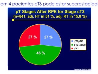 1 em 4 pacientes cT3 pode estar superestadiado