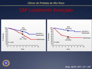 Câncer de Próstata de Alto RiscoCAP Localmente AvançadoSobrevida GlobalSobrevida Livre de Doença85%10010079%(78-92%)9090(72-86%)Hormônio +8080Radioterapia7070Hormônio +6060Radioterapia5050% Pacientes% Pacientes62%Radioterapia48%4040(52 -72%)Radioterapia(38-58%)30302020P<0.001P= 0.001101000012345678910012345678910AnosAnosBolla, NEJM 1997; 337: 295