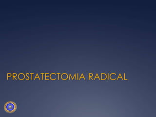 PROSTATECTOMIA RADICAL