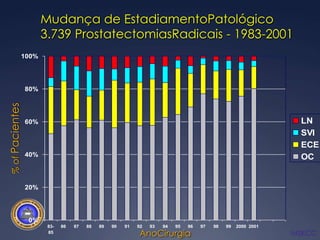 Mudança de EstadiamentoPatológico3.739 ProstatectomiasRadicais - 1983-2001% of PacientesAnoCirurgiaMSKCC