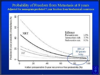 Prostatectomia radical foiassociada a menorrisco de óbitodevidoao Cap.				[HR] 0.32 (95% CI, 0.13 to 0.80; P.015)“Metastasis After RP or EBRT…”Resultados