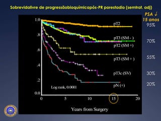 Sobrevidalivre de progressãobioquímicapós-PR porestadio (semtrat. adj)PSA  15 anos95%70%55%30%20%MSKCC