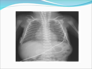 lesson 1 High_Risk_Neonatal_Nursing_Care[1].ppt