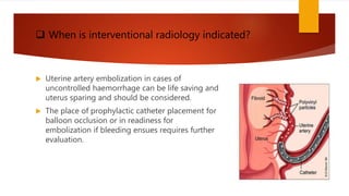 High risk obstetrics | PPTX