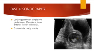 High risk obstetrics | PPTX