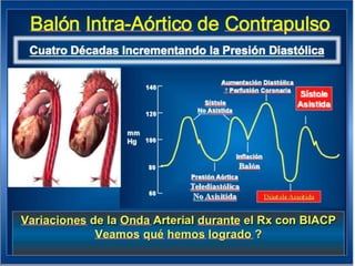 UPDATE OF HIGH RISK PCI . . . IMPELLA vs IABP : INCLUDES  THE SHOCK II TRIAL