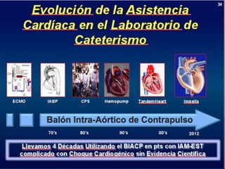 UPDATE OF HIGH RISK PCI . . . IMPELLA vs IABP : INCLUDES  THE SHOCK II TRIAL