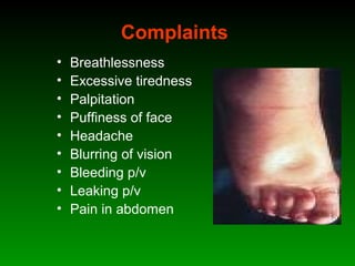 Complaints
• Breathlessness
• Excessive tiredness
• Palpitation
• Puffiness of face
• Headache
• Blurring of vision
• Bleeding p/v
• Leaking p/v
• Pain in abdomen
 
