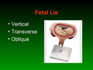 Fetal Lie
• Vertical
• Transverse
• Oblique
 