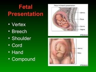 Fetal
Presentation
• Vertex
• Breech
• Shoulder
• Cord
• Hand
• Compound
 