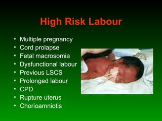 High Risk Labour
• Multiple pregnancy
• Cord prolapse
• Fetal macrosomia
• Dysfunctional labour
• Previous LSCS
• Prolonged labour
• CPD
• Rupture uterus
• Chorioamniotis
 