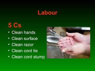 Labour
5 Cs
• Clean hands
• Clean surface
• Clean razor
• Clean cord tie
• Clean cord stump
 
