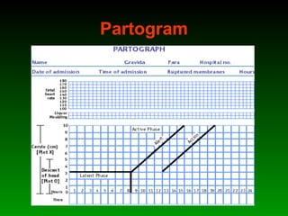 Partogram
 