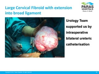 30Copyright © 2014 Paras Hospitals. All rights reserved.
Large Cervical Fibroid with extension
into broad ligament
Urology...