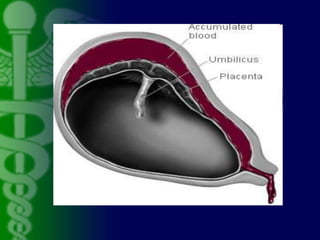 Incompetent cervix
• Premature dilation of the
cervix
• Is a defect related trauma of
the cervix or a congenitally
short c...