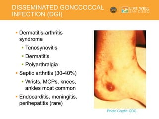 08.21.20 | Sexually Transmitted Infections – 2020 Update | PPTX