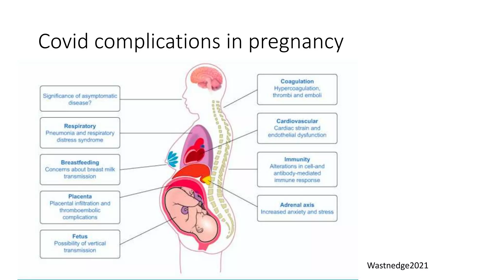 Covid complications in pregnancy
Wastnedge2021
 