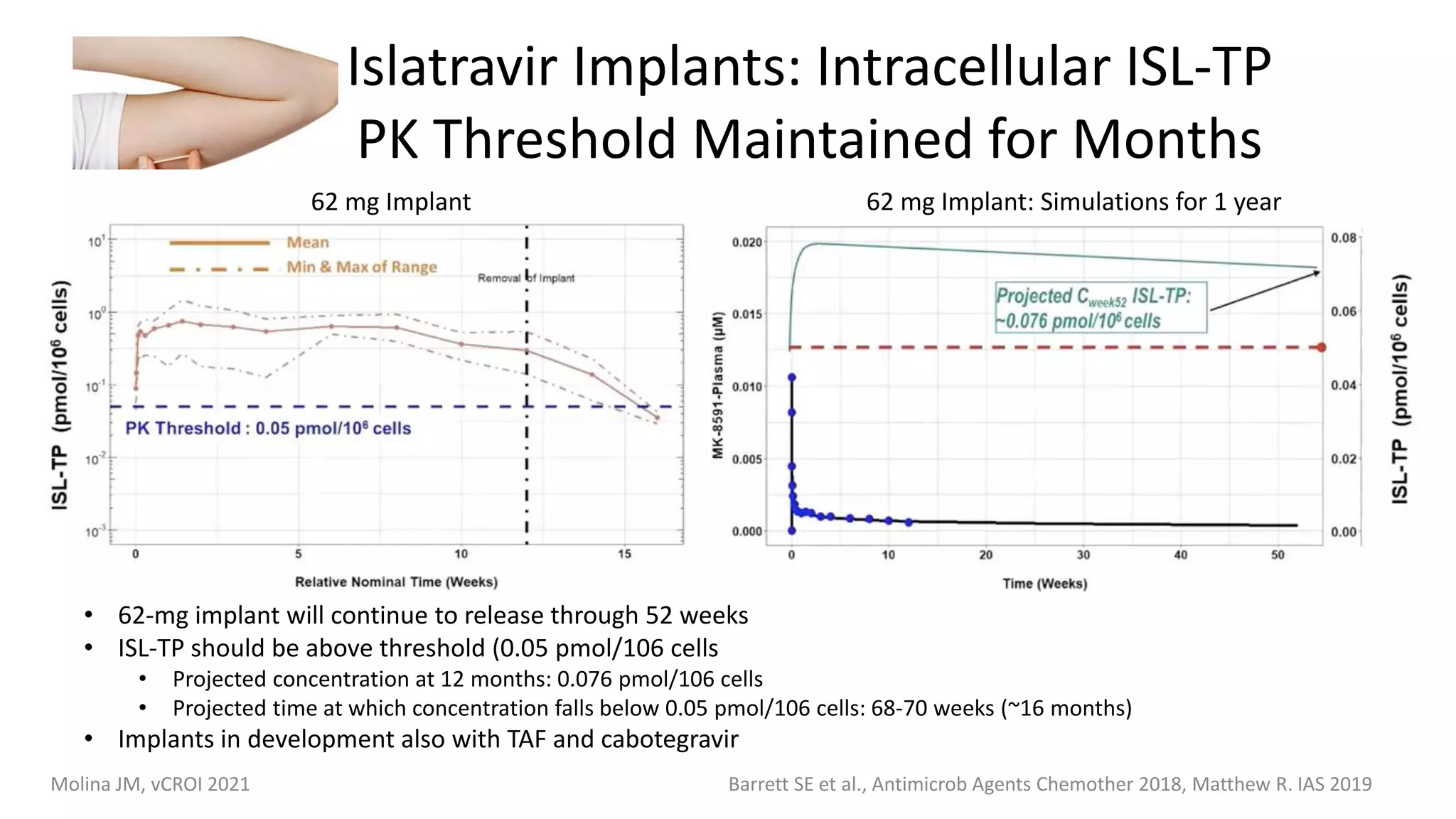 Islatravir Implants: Intracellular ISL-TP
PK Threshold Maintained for Months
Barrett SE et al., Antimicrob Agents Chemother 2018, Matthew R. IAS 2019
• 62-mg implant will continue to release through 52 weeks
• ISL-TP should be above threshold (0.05 pmol/106 cells
• Projected concentration at 12 months: 0.076 pmol/106 cells
• Projected time at which concentration falls below 0.05 pmol/106 cells: 68-70 weeks (~16 months)
• Implants in development also with TAF and cabotegravir
62 mg Implant 62 mg Implant: Simulations for 1 year
Molina JM, vCROI 2021
 