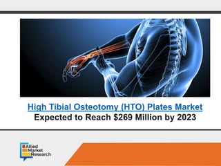 Opportunity Analysis and IndustryForecast,2016-2023
Global OpportunityAnalysisand
IndustryForecast,
2018-2025
High Tibial Osteotomy (HTO) Plates Market
Expected to Reach $269 Million by 2023
 