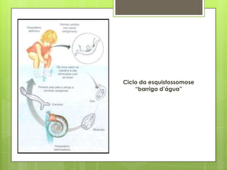 Ciclo da esquistossomose
“barriga d’água”
 